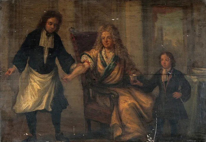 Framed Print : A surgeon letting blood from a man's arm, c1740s. Creator: Unknown. A surgeon letting blood from a man's arm, c1740s. Creator: Unknown Framed Print : A surgeon letting blood from a man's arm, c1740s. Creator: Unknown. A surgeon letting blood from a man's arm, c1740s. Creator: Unknown