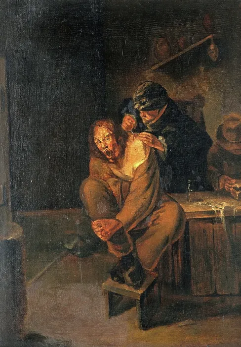 Framed Print : A surgeon operating on a man's shoulder, c1640s. Creator: Unknown. A surgeon operating on a man's shoulder, c1640s. Creator: Unknown Framed Print : A surgeon operating on a man's shoulder, c1640s. Creator: Unknown. A surgeon operating on a man's shoulder, c1640s. Creator: Unknown