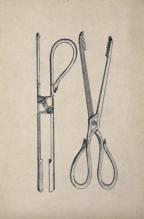 Framed Print : Surgical instruments. Creator: Unknown Framed Print : Surgical instruments. Creator: Unknown