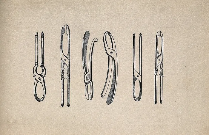 Framed Print : Surgical instruments. Creator: Unknown Framed Print : Surgical instruments. Creator: Unknown