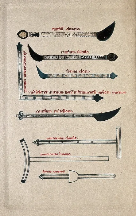 Framed Print : Surgical instruments, mainly cautery irons. Creator: Unknown Framed Print : Surgical instruments, mainly cautery irons. Creator: Unknown