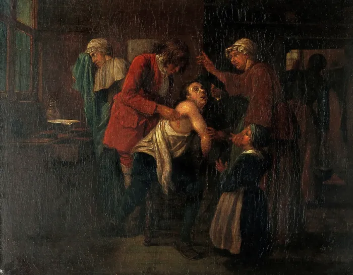 Framed Print : A surgical operation, between 1720 and 1729?. Creator: Jan Josef Horemans I Framed Print : A surgical operation, between 1720 and 1729?. Creator: Jan Josef Horemans I