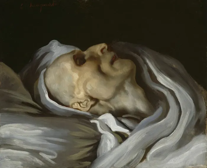 Framed Print : Theodore Gericault on His Deathbed, 1824. Creator Framed Print : Theodore Gericault on His Deathbed, 1824. Creator