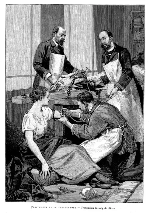 Framed Print : A tuberculosis patient being given a transfusion of goats blood, 1891 Framed Print : A tuberculosis patient being given a transfusion of goats blood, 1891