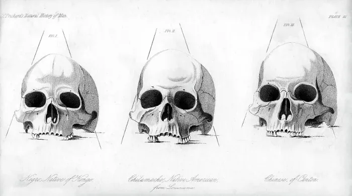 Framed Print : Three types of human skull, 1848 Framed Print : Three types of human skull, 1848