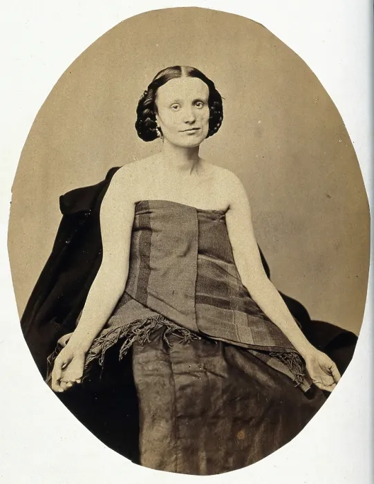 Framed Print : A woman seated; she is partially clothed with her arms extended and the left side of her... c1865. Creator: L. Haase & Company Framed Print : A woman seated; she is partially clothed with her arms extended and the left side of her... c1865. Creator: L. Haase & Company
