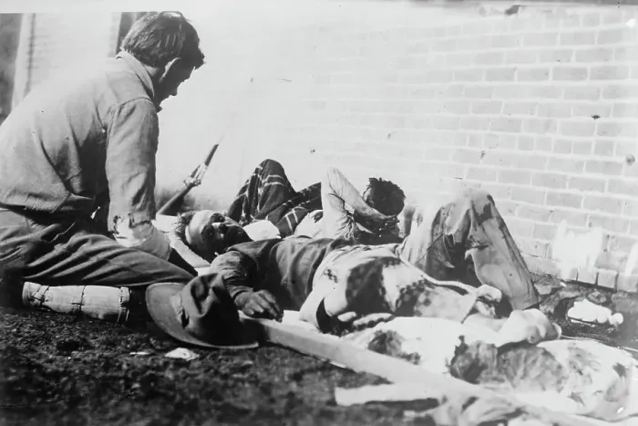 Framed Print : Wounded at Juarez, between c1910 and c1915. Creator: Bain News Service Framed Print : Wounded at Juarez, between c1910 and c1915. Creator: Bain News Service