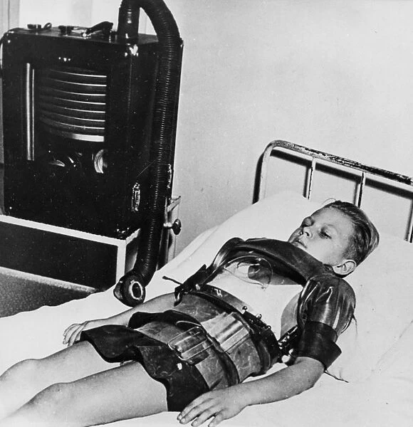 Eleven yeat old boy in an iron lung, Beaujon Hospital, Paris, c1947-1951