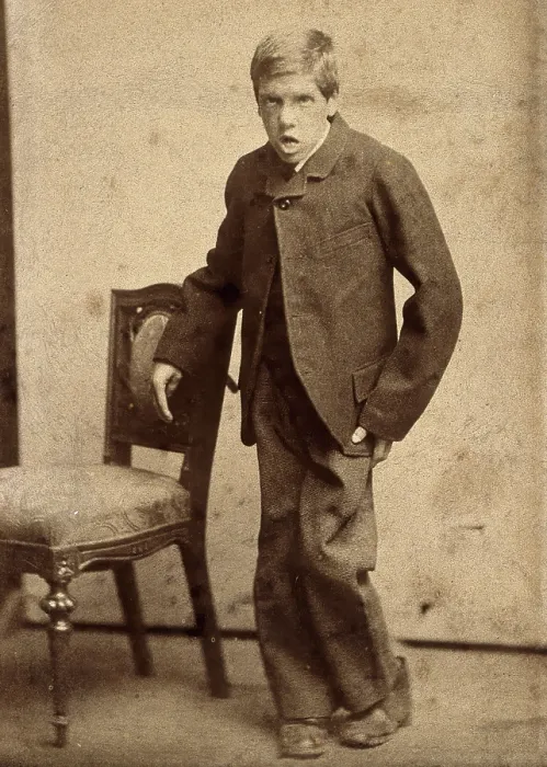 Framed Print : A young man, showing signs of mental deficiency, leaning awkwardly... c1890s. Creator: Davis Framed Print : A young man, showing signs of mental deficiency, leaning awkwardly... c1890s. Creator: Davis