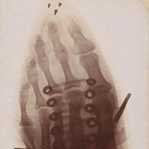 Le pied a travers la chaussure, 1896. Creator: Henri van Heurck