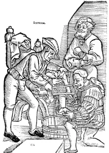 Hans Von Prints: Amputation of a leg without anaesthetic, 1593