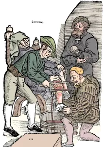 Amputation of a leg without anaesthetic, 1593
