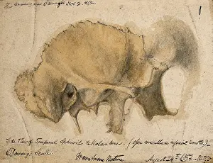 Whishaw Prints: Bones of the cheek: side view of the temporal