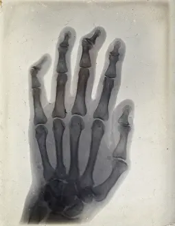 Bone Prints: The bones of a hand, viewed through x-ray, 1895