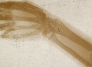 1896 Prints: The bones of a hand and wrist, viewed through x-ray, 1896