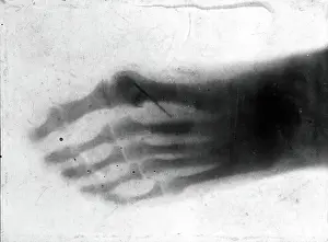 1896 Prints: The bones of a pantomime artist's foot