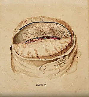 Cross Section Prints: Brain: dissection showing a section of the right hemisphere