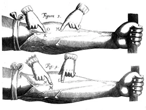 Circulation of the blood, 1628 Circulation of the blood, 1628