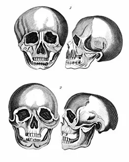 Comparison of Germanic and African skulls, early 19th century