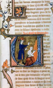 Images Dated 20th November 2006: Cupping, 14th century