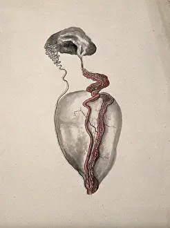 Illustrations Prints: A diseased part of the body. Creator: Unknown