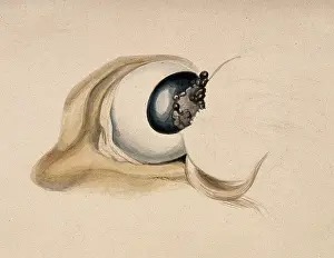 A diseased eye. Creator: Unknown