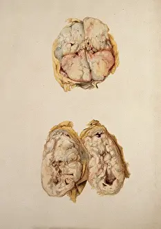 Illustrations Prints: Two diseased parts of the body. Creator: Unknown