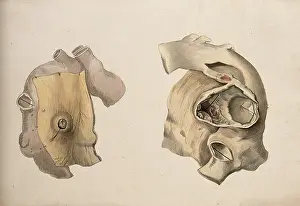 Illustrations Prints: Two diseased parts of the body. Creator: Unknown