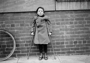 Crutch Prints: Dr. Freedman - Children Cured By His Cure