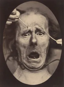 Duchenne Prints: Electro-Physiologie, Figure 64, 1854-56, printed 1862. Creator: Adrien Alban Tournachon