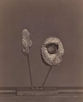 Bell William Gallery: Excised Knee Joint. A Round Musket Ball in the Inner Condyle of the Right Femur [Gardin