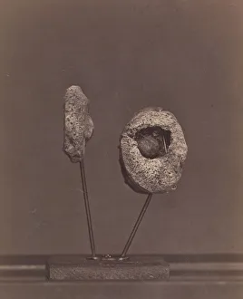 Excised Knee Joint. A Round Musket Ball in the Inner Condyle of the Right Femur [Gardin