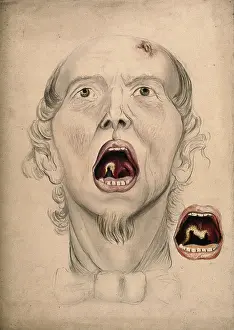 1866 Prints: The face of a man, with mouth open wide