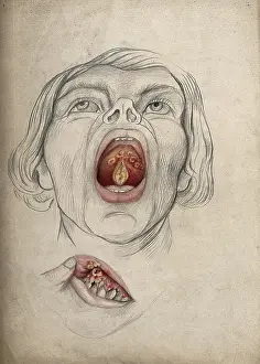 Open Mouth Prints: The face of a man, with mouth open wide