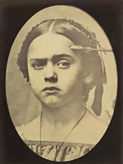 Figure 10: Showing the expressive lines of m. frontalis in a young girl, 1854-56