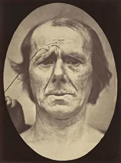 Boulogne Gallery: Figure 19: Suffering, 1854-56, printed 1862. Creators: Duchenne de Boulogne
