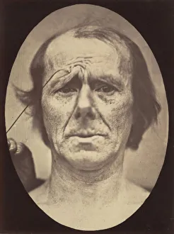 Adrien Tournachon Gallery: Figure 19: Suffering, 1854-56, printed 1862. Creators: Duchenne de Boulogne