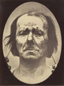 Figure 20: Profound suffering, with resignation, 1854-56, printed 1862 Figure 20: Profound suffering, with resignation, 1854-56, printed 1862