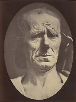 Adrien Tournachon Gallery: Figure 22: No painful expression, 1854-56, printed 1862