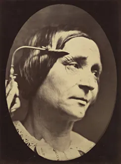 Adrien Tournachon Gallery: Figure 27: Expression proportionally more pained, 1854-56, printed 1862