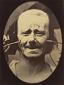 Adrien Tournachon Gallery: Figure 34: Grimace, 1854-56, printed 1862. Creators: Duchenne de Boulogne