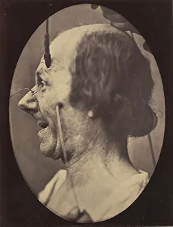 Adrien Tournachon Gallery: Figure 39: The attention attracted by an object that provokes lascivious
