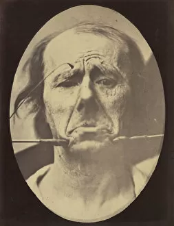 Boulogne Gallery: Figure 45: Pain and despair. 1854-56, printed 1862. Creators: Duchenne de Boulogne