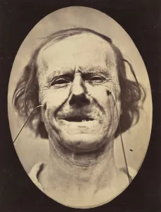 Duchenne Prints: Figure 48: Mild weeping, pity and feeble false laughter, 1854-56, printed 1862
