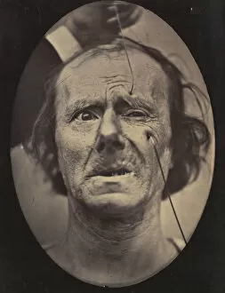 Figure 49: Painful weeping and forward looking. 1854-56, printed 1862
