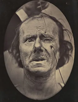 Adrien Tournachon Gallery: Figure 49: Painful weeping and forward looking. 1854-56, printed 1862