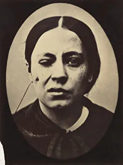 Duchenne Prints: Figure 50: Affected weeping and face in repose, 1854-56, printed 1862