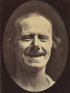 Adrien Tournachon Gallery: Figure 52: Voluntary retraction of the lower lip, 1854-56, printed 1862
