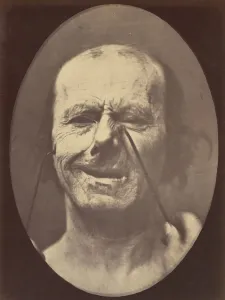 Duchenne Prints: Figure 53: Whimpering and false laughter, 1854-56, printed 1862