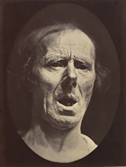 Duchenne Prints: Figure 54: Voluntary lowering of the lower jaw, 1854-56, printed 1862